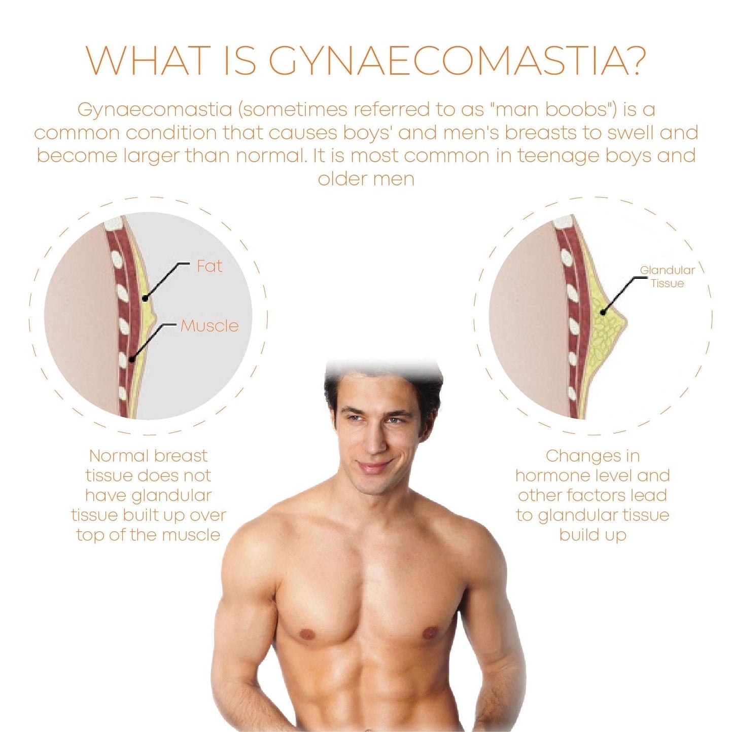 FORMAN Gynecomastia FatBurning Spray