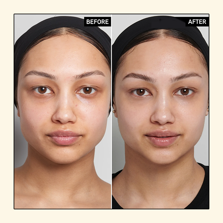 Gold Caviar™ Elektrischer Zauberstab Augencreme