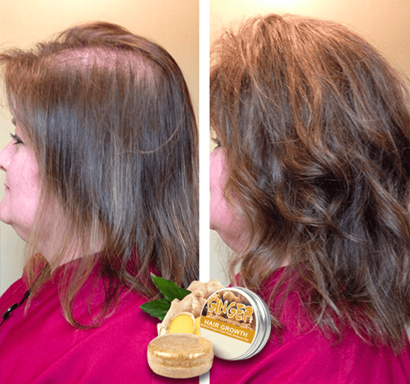 GingerPro Hair Regrowth Shampoo Bar