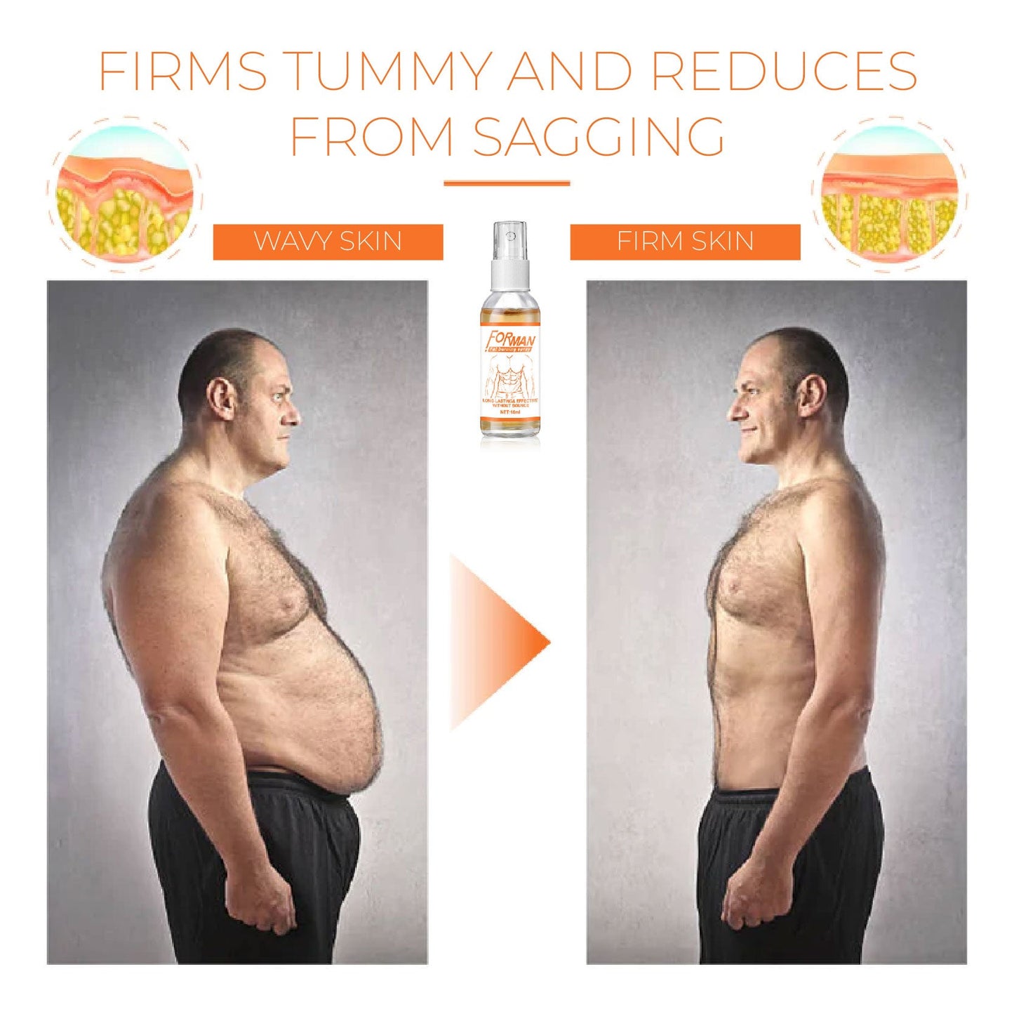 FORMAN Gynecomastia FatBurning Spray