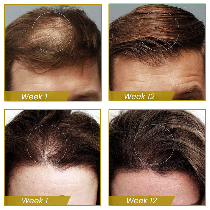 Shouga Hair Growth Powder