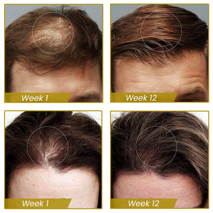 Shouga Hair Growth Powder