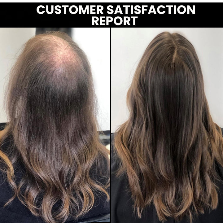 Shouga Kingu Hair Growth Oil