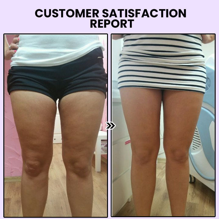 Smoothia Moisturise AntiCellulite Patch