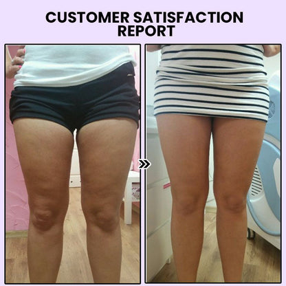 Smoothia Moisturise AntiCellulite Patch