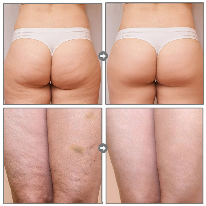 Smoothia Moisturise AntiCellulite Patch