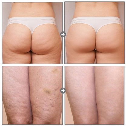 Smoothia Moisturise AntiCellulite Patch