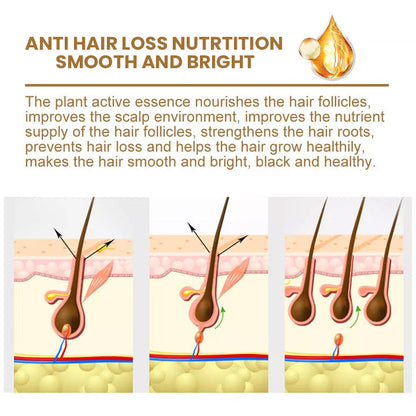 Suna Plant Extract Hair Growth Oil