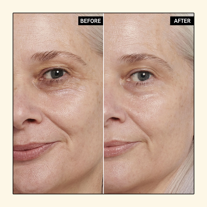 Gold Caviar™ Elektrischer Zauberstab Augencreme