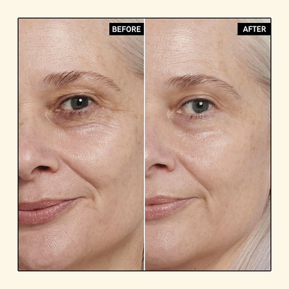 Gold Caviar™ Elektrischer Zauberstab Augencreme