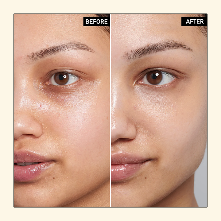 Gold Caviar™ Elektrischer Zauberstab Augencreme