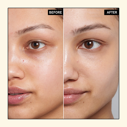 Gold Caviar™ Elektrischer Zauberstab Augencreme