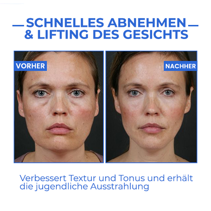 Youthfully™ Botox Gesichtsserum