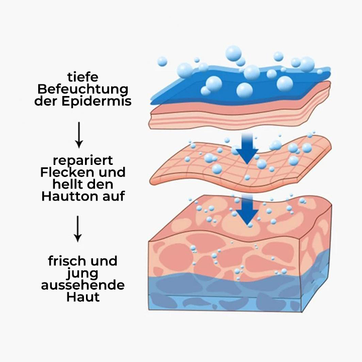 Spot-Off™ Aufhellungscreme für Sommersprossen