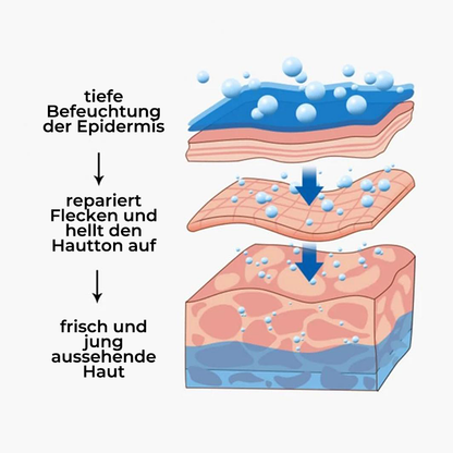 Spot-Off™ Aufhellungscreme für Sommersprossen